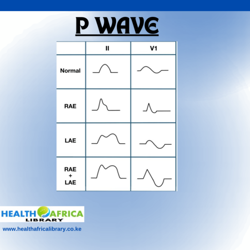 p_wave_01